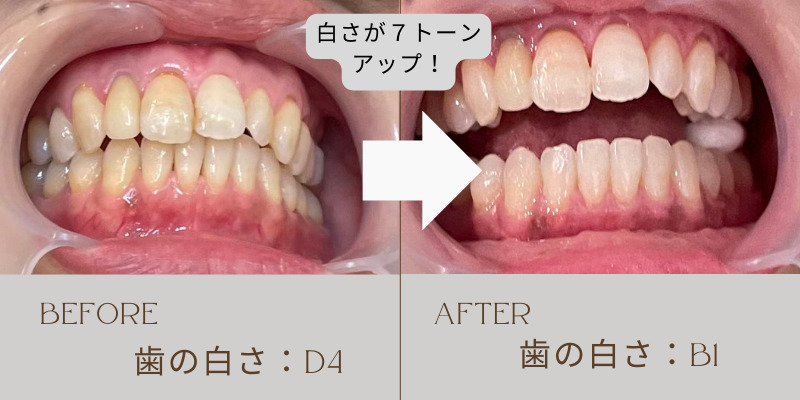 beforeafter