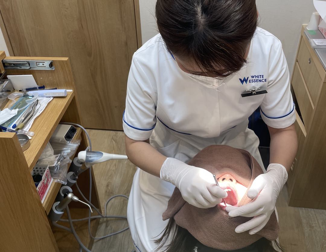 ホワイトエッセンス歯石取り